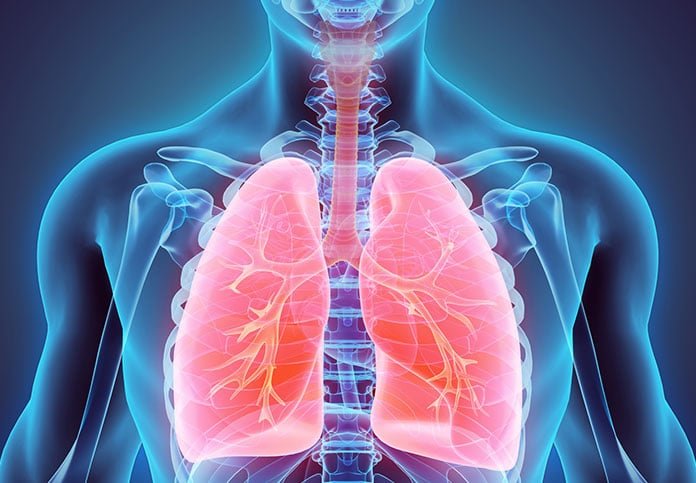 Entenda As Diferenças Entre Os Tipos De Pneumonia