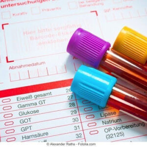 HIPOCALEMIA: O Que é, Sintomas, Tratamentos E Causas